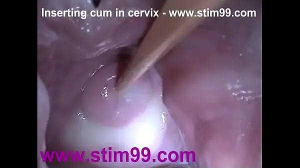 New Insertion Semen Cum in Cervix Wide Stretching Pussy Speculum top Movies