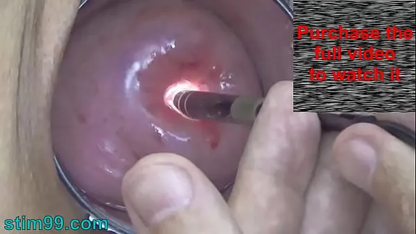 New Endoscope Camera inside Cervix Cam into Pussy Uterus top Movies